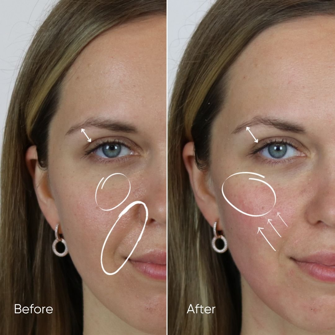 Zemits HydroVerstand PRO Sistem 7-în-1 HydroDiamond™