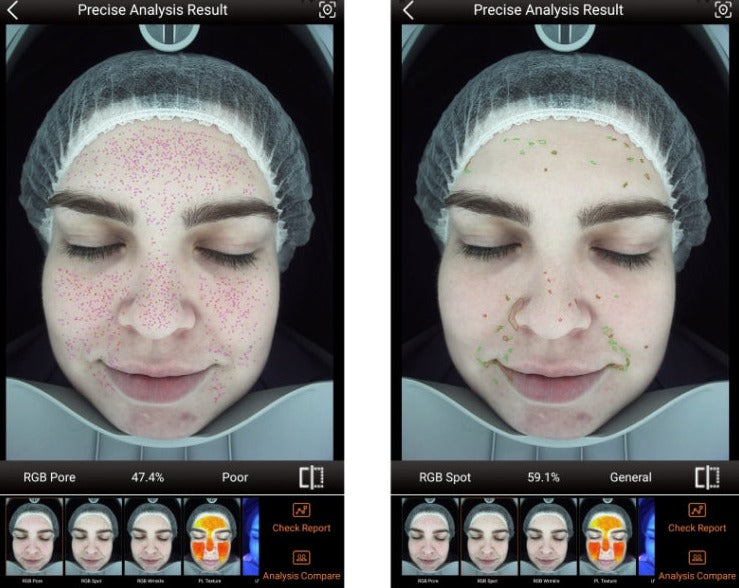 Zemits VeraFace Sistem de Analiză a Pielii