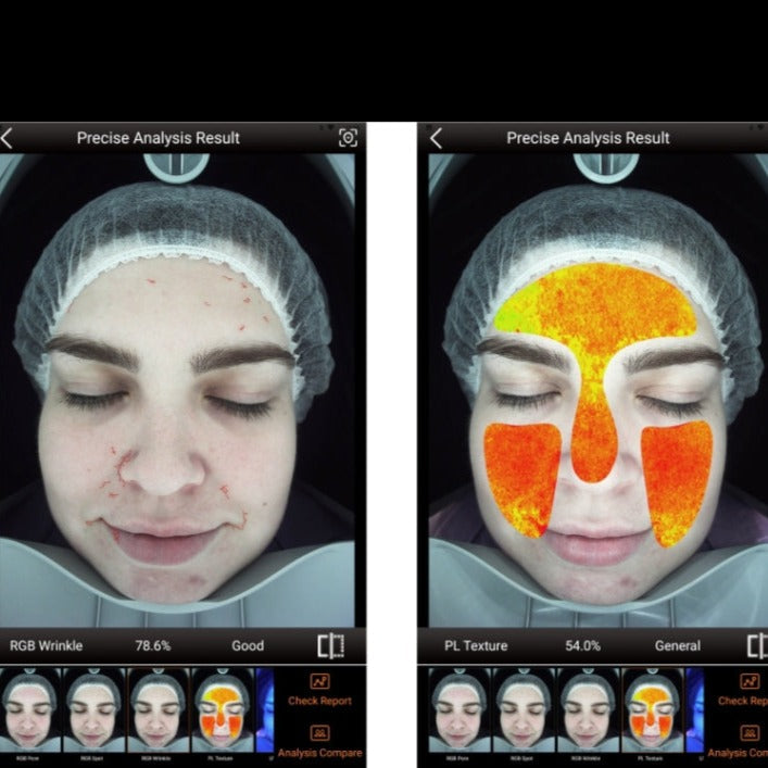 Zemits VeraFace Sistem de Analiză a Pielii